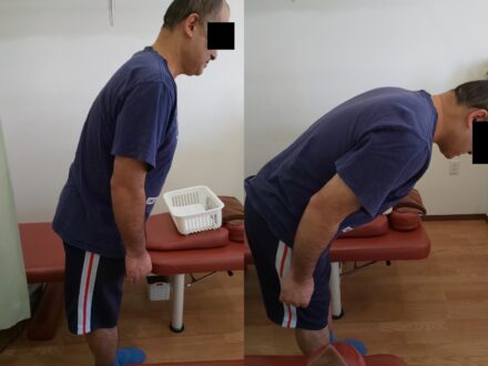 前屈みで腰が痛い患者さんの施術の前後での変化